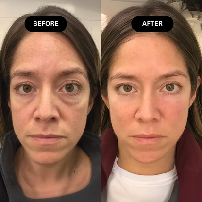 BrightLift 3-in-1 Eye Repair Concealer