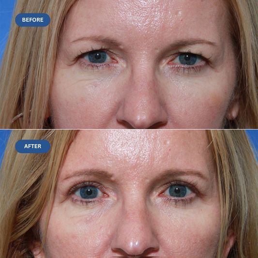 EyeLift Re-Tone Cream